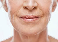 Fine lines and wrinkles